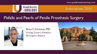 Pitfalls and Pearls of Penile Prosthesis Surgery