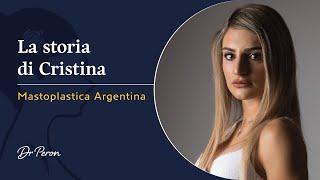 Mastoplastica Additiva Risultati: Scopri l'Esperienza di Cristina