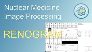 Renogram-renal imaging- Processing, in nuclear medicine