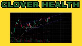 Analyzing the Market Landscape: A Deep Dive into Clover Health CLOV Stock