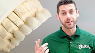 Veneers - What is the Best Veneer Procedure for Dentists?