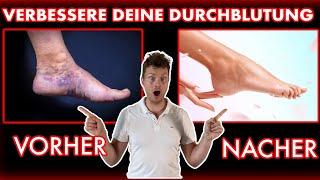 Durchblutung Boost: 5 Übungen für schmerzfreie & strahlende Beine - Krampfadern adé!