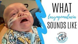 What Laryngomalacia Sounds Like | noisy breathing | newborn congestion