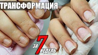 ТРАНСФОРМАЦИЯ: идеальные ногти и кутикула за 7 недель