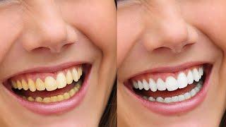 Whiten teeth in photoshop #shorts #phtoshoptutorial