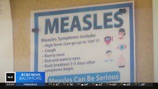 Maryland resident has case of measles, health department confirms