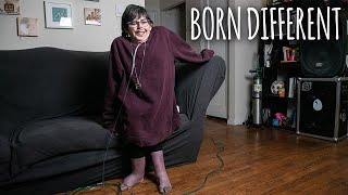 I Was Born With A Third Arm On My Head | BORN DIFFERENT