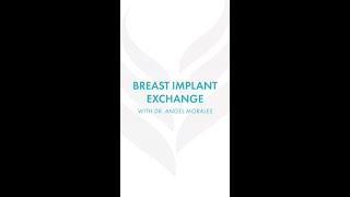 Breast implant exchange after 30 years - Dr. Angel Morales