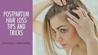 Postpartum Hair Loss Tips and Tricks