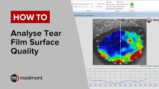 How To | Analyse Tear Film Surface Quality (Studio 6)