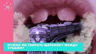 Нужно ли убирать щербинку между зубами? Отвечает стоматолог