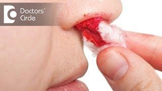 Can nose bleeds be caused by heat?-Dr. Satish Babu K