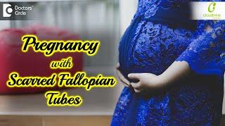 Getting PREGNANT with Scarred Fallopian Tubes-Dr.Sophia Devi of Cloudnine Hospitals| Doctors' Circle