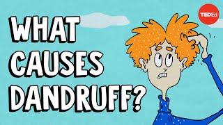 What causes dandruff, and how do you get rid of it? - Thomas L. Dawson
