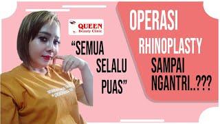 FOTO-FOTO HASIL RHYNOPLASTY DI QUEEN KLINIK KECANTIKAN