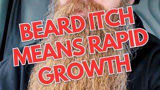 Beard Itch Means Rapid Growth | Beard Life | Braw Beard (2023) #beardfacts #beardlife