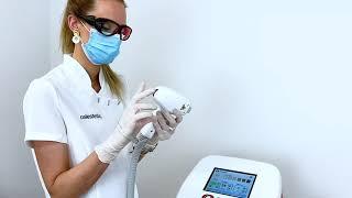 Appareil d’épilation définitive au diode laser avec EPIL PRO II