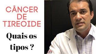 Tipos de câncer de tireóide - Dr. Rogério Leite