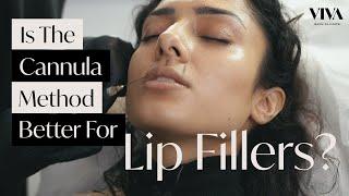 The Cannula Method For Lip Fillers?  (2021) Natural Lip Filler