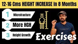 Best HEIGHT INCREASE EXERCISES For Microfracture And More HGH