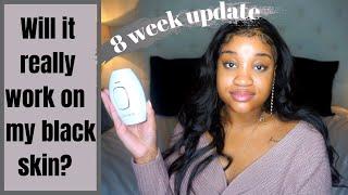 Lux Skin IPL Laser Hair Removal Review | 8 week UPDATE| Laser Hair Removal on Dark Skin