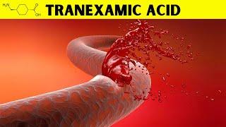 Tranexamic Acid - An Effective Method To Control Bleeding Fast