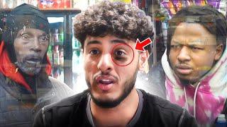 Customers in the Hood React to my Black eye (Part 3) | Nick came back