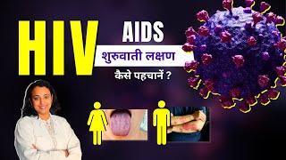 HIV Symptoms in Men & Women - AIDS Aur HIV ke Lakshan Kya Hote Hai?