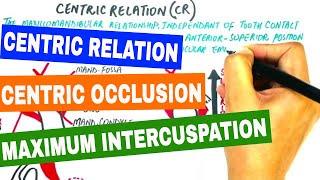 Centric Relation, Centric Occlusion & Maximum Intercuspation