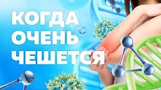 ЛЕЧЕНИЕ ПСОРИАЗА / КАК ИЗБАВИТЬСЯ ОТ ШЕЛУШЕНИЙ КОЖИ?