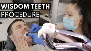 Wisdom Teeth Extraction PROCEDURE | How to Prepare, What to Expect & Cost