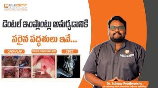 The 3 Types of Dental Implant Placement Explained | Dental care in Telugu | Eledent Dental Hospitals