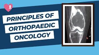 Principles of Orthopaedic Oncology and Bone Tumours for the FRCS Ortho Exam