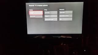 xbox series x blinking black screen FIXED