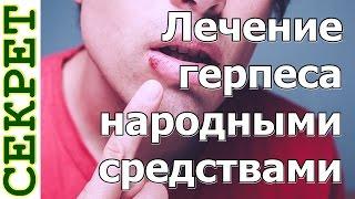 Лечение герпеса народными средствами