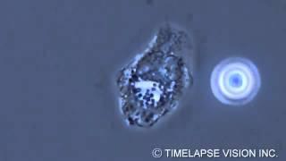 Bacterial phagocytosis by neutrophils