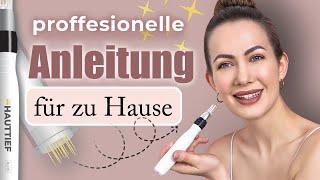 Microneedling selber machen | Vorher & Nachher