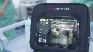 YOUKEY wireless ultrasound Guided puncture