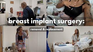 CHANGING MY BREAST IMPLANTS AFTER 12 YEARS: VLOG | Breast Augmentation | Breast Implant Replacement