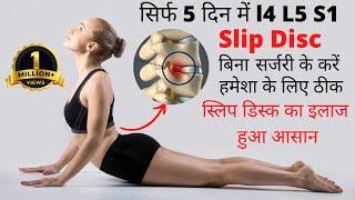 L4-L5-S1 Slipped Disc Treatment | Slipped disc exercises | disc bulge exercises