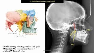 Identifiable anatomical structures in lateral cephalometric radiograph (ceph tracing 1)