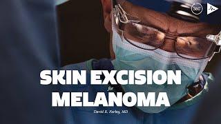 Skin Excision for Melanoma by David R. Farley, MD | Case Trailer