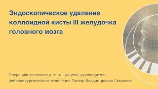 Эндоскопическое удаление коллоидной кисты III желудочка головного мозга