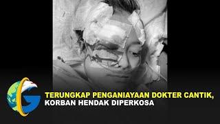 Terungkap Penganiayaan Dokter Cantik Oleh Petugas Security Hotel, Korban Hendak Diperkosa