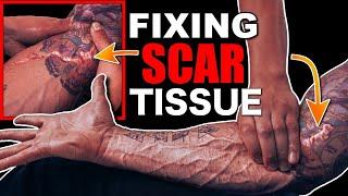 The Worst Pain️BREAKING DOWN SCAR TISSUE | If You've Been Hurt You NEED To Try THIS! (Lex Fitness)