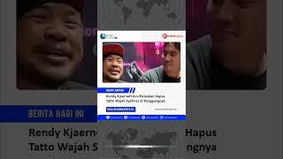 Rendy Kjaernett Kini Putuskan Hapus Tatto Wajah Syahnaz di Punggungnya