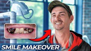 "Who's Your DENTIST?!" - Dental Implant Transformation at Atlanta Dental Spa