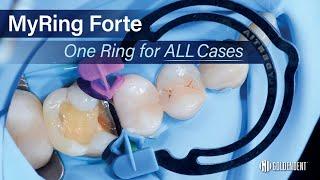 Polydentia MyRing Forte Sectional Matrix Ring - One Ring With Adaptable Tines for All Cases