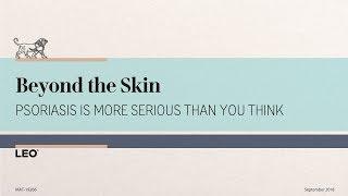 Psoriasis: Beyond the Skin