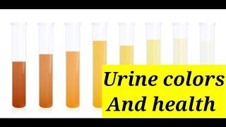 What your urine colors says about your health #urine #kidney